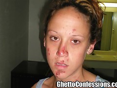 Bree Is A Skank Junkie Street Walking Ho. She Shares The Recent Story Of How She Was Beat Down Getting Road Rash On Her Fa^ghetto Confessions Homemade